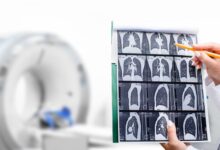 Why Medical Imaging Is Critical for Accurate Diagnoses