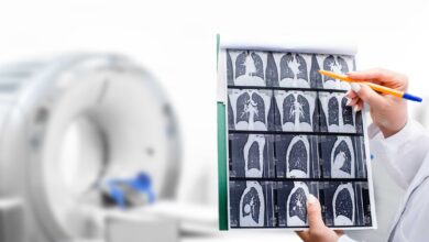 Why Medical Imaging Is Critical for Accurate Diagnoses