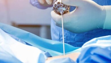 What Is PECD Uniportal Surgery and Why It’s Changing Spinal Treatment