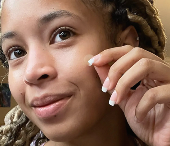 Can I Use Hydrocolloid Bandages for Acne Instead of Patches?